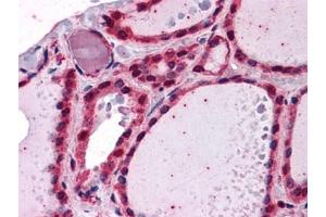 Immunohistochemistry (IHC) image for anti-Interleukin-1 Receptor-Associated Kinase 1 (IRAK1) (AA 530-693) antibody (ABIN614625)