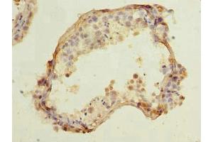 Immunohistochemistry of paraffin-embedded human testis tissue using ABIN7148124 at dilution of 1:100