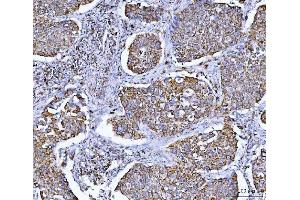 IHC analysis of GLUD1/2 using anti-GLUD1/2 antibody (ABIN7602000). (GLUD1 / GLUD2 (AA 54-553) anticorps)