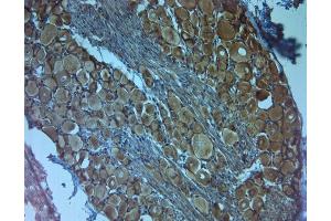 IHC on paraffin sections of rat DRG using Rabbit antibody to TrkC .