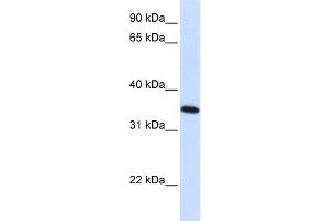 WB Suggested Anti-RTN1 Antibody Titration:  0. (Reticulon 1 anticorps  (N-Term))