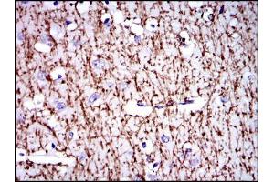 Immunohistochemical analysis of paraffin-embedded brain tissues using MBP mouse mAb with DAB staining. (MBP anticorps)
