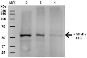 Western Blot analysis of Human A431, HEK293, and Jurkat cell lysates showing detection of ~58 kDa PP5 protein using Mouse Anti-PP5 Monoclonal Antibody, Clone 12F7 . (PP5 anticorps  (APC))