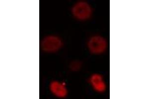 ABIN6274512 staining NIH-3T3 cells by IF/ICC. (ZSCAN16 anticorps)