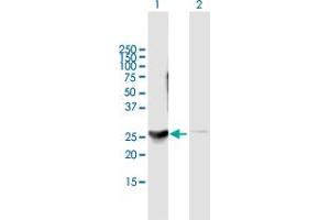Western Blot analysis of DENR expression in transfected 293T cell line by DENR MaxPab polyclonal antibody. (Density Regulated Protein anticorps  (AA 1-198))
