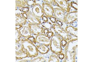 Immunohistochemistry of paraffin-embedded rat kidney using MT-CO3 antibody (ABIN7266636) at dilution of 1:100 (40x lens). (COX3 anticorps)
