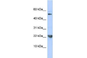 WB Suggested Anti-TNFSF12 Antibody Titration:  0. (TWEAK anticorps  (N-Term))