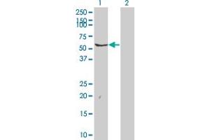 Western Blot analysis of FYN expression in transfected 293T cell line by FYN monoclonal antibody (M02), clone 3A8.