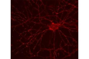 Indirect immunostaining of hippocampus neurons (dilution 1 : 500).