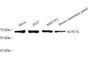 Western blot analysis of SUPT7L (ABIN7075768) at dilution of 1: 2000 (SUPT7L anticorps)