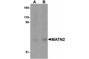 Image no. 1 for anti-Matrilin 2 (MATN2) (C-Term) antibody (ABIN478061)
