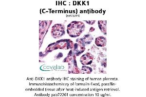 Image no. 1 for anti-Dickkopf Homolog 1 (DKK1) (C-Term) antibody (ABIN1733668) (DKK1 anticorps  (C-Term))