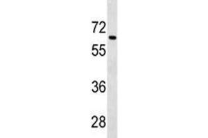 Tgfbr2 antibody western blot analysis in 293 lysate. (TGFBR2 anticorps  (AA 548-575))