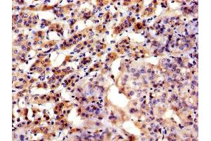 IHC image of ABIN7144757 diluted at 1:300 and staining in paraffin-embedded human adrenal gland tissue performed on a Leica BondTM system.
