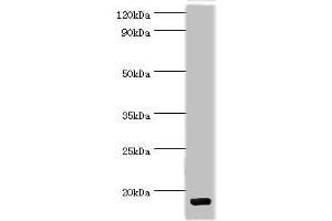 Western blot All lanes: C-C motif chemokine 28 antibody at 5 μg/mL + Mouse spleen tissue Secondary Goat polyclonal to rabbit IgG at 1/10000 dilution Predicted band size: 15, 13 kDa Observed band size: 15 kDa
