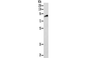 Gel: 10 % SDS-PAGE, Lysate: 40 μg, Lane: Lovo cells, Primary antibody: ABIN7128422(ANTXR1 Antibody) at dilution 1/200, Secondary antibody: Goat anti rabbit IgG at 1/8000 dilution, Exposure time: 2 minutes (ANTXR1 anticorps)