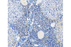 Immunohistochemistry of paraffin-embedded Rat ovary using Myogenin Polyclonal Antibody at dilution of 1:100 (20x lens). (Myogenin anticorps)