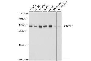 Western blot analysis of extracts of various cell lines using CACYBP Polyclonal Antibody at dilution of 1:1000. (CACYBP anticorps)