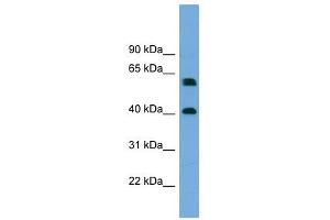 TERF2IP antibody used at 1 ug/ml to detect target protein. (RAP1 anticorps  (Middle Region))