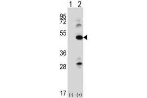 Western blot analysis of ILK antibody and 293 cell lysate either nontransfected (Lane 1) or transiently transfected (2) with the ILK gene. (ILK anticorps  (AA 225-253))