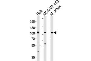 Western Blotting (WB) image for anti-Nuclear Receptor Coactivator 7 (NCOA7) antibody (ABIN3004220) (NCOA7 anticorps)