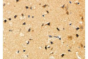 ABIN6256930 and ABIN6275913 at 1/100 staining Mouse brain tissue by IHC-P.