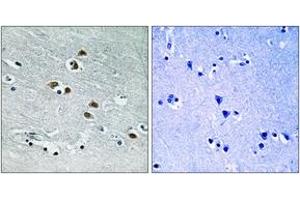 Immunohistochemistry analysis of paraffin-embedded human brain tissue, using HDAC6 (Ab-22) Antibody. (HDAC6 anticorps  (AA 7-56))