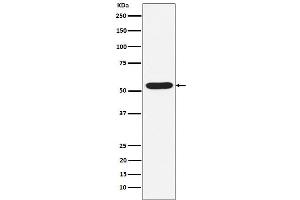 Western blot analysis of PIAS2 expression in HepG2 cell lysate.