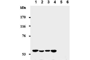 Western Blotting (WB) image for anti-Cyclin-Dependent Kinase Inhibitor 1C (p57, Kip2) (CDKN1C) antibody (ABIN487486) (CDKN1C anticorps)