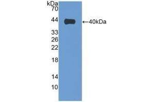 Detection of Recombinant VIL1, Human using Polyclonal Antibody to Villin (VIL)
