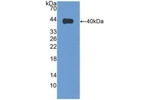 Detection of Recombinant VIL1, Human using Polyclonal Antibody to Villin (VIL) (Villin 1 anticorps  (AA 1-320))