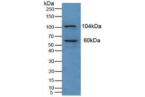 Detection of PKN1 in Human Liver Tissue using Polyclonal Antibody to Protein Kinase N1 (PKN1) (PKN1 anticorps  (AA 615-874))