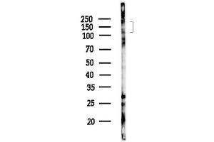anti-Peroxisomal Biogenesis Factor 1 (PEX1) (N-Term) antibody