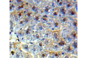 Used in DAB staining on fromalin fixed paraffin-embedded liver tissue (HMGB2 anticorps  (AA 2-187))