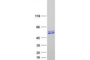 Validation with Western Blot