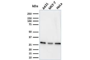 anti-Myofibroblast Marker antibody
