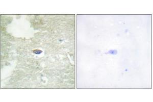 Immunohistochemistry analysis of paraffin-embedded human brain tissue, using TGF beta Receptor II (Phospho-Ser225/250) antibody. (TGFBR2 anticorps  (pSer225, pSer250))