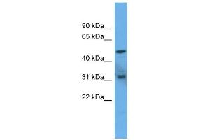 Western Blot showing ADCYAP1R1 antibody used at a concentration of 1-2 ug/ml to detect its target protein. (ADCYAP1R1 anticorps  (C-Term))