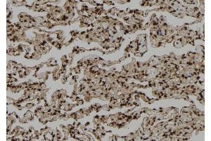 ABIN6264466 and ABIN6272402 at 1/100 staining Human lung tissue by IHC-P. (PSKH1 anticorps  (Internal Region))
