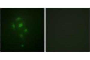 Immunofluorescence analysis of A549 cells, using MSK1 (Phospho-Thr581) Antibody. (MSK1 anticorps  (pThr581))