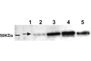 Western Blotting (WB) image for anti-Amylase, alpha (AMY) antibody (ABIN619546) (Amylase, alpha anticorps)
