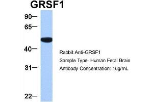 Host:  Rabbit  Target Name:  GRSF1  Sample Type:  Human Fetal Brain  Antibody Dilution:  1. (GRSF1 anticorps  (Middle Region))
