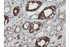 Image no. 3 for anti-Src-like-adaptor 2 (SLA2) antibody (ABIN1500949) (SLAP2 anticorps)