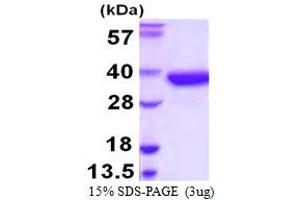 SDS-PAGE (SDS) image for Sulfotransferase Family, Cytosolic, 1A, Phenol-Preferring, Member 2 (SULT1A2) (AA 1-295) protein (His tag) (ABIN5780190) (SULT1A2 Protein (AA 1-295) (His tag))