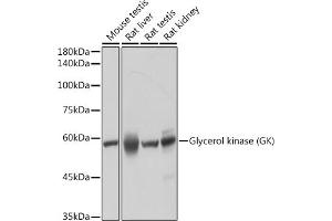 Western blot analysis of extracts of various cell lines, using Glycerol kinase (GK) (GK) antibody (ABIN7267457) at 1:1000 dilution. (Glycerol Kinase anticorps)