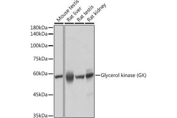 Glycerol Kinase anticorps