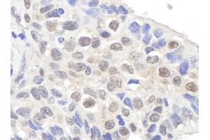 Immunohistochemistry (IHC) image for anti-Claspin (CLSPN) (AA 725-775) antibody (ABIN7454603)
