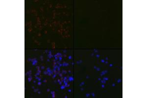 Immunofluorescence analysis of 293T Treated with Chloroquine and 293T cells using [KO Validated] LC3B Rabbit mAb (ABIN7268519) at dilution of 1:100 (40x lens).