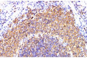 Immunohistochemistry of paraffin-embedded Rat spleen using IL6R Polyclonal Antibody at dilution of 1:200 (IL-6 Receptor anticorps)