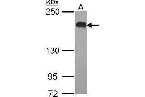 WB Image Sample (30 ug of whole cell lysate) A: Hela 5% SDS PAGE USP47 antibody antibody diluted at 1:1000 (USP47 anticorps)